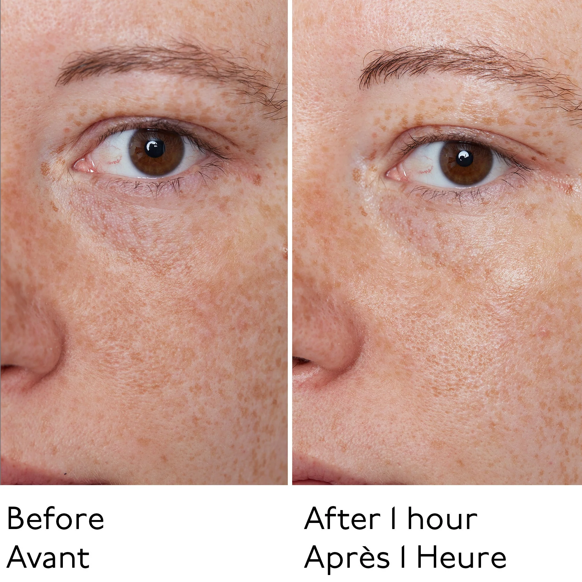 HYALURONIC GLOBAL FACE CREAM TRAVEL-SIZE - Image 5